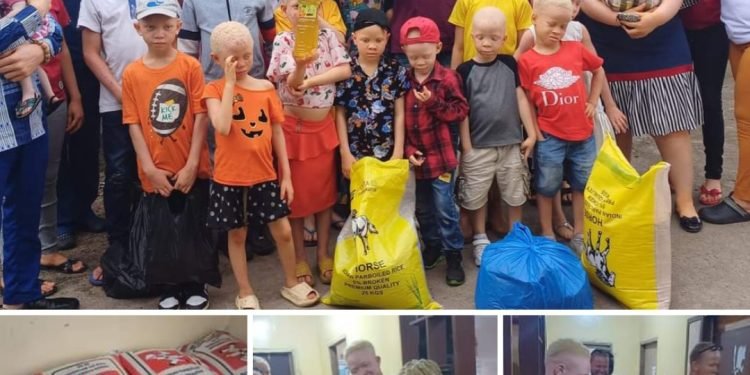 Liberia Albino Society Donates Food and Non Food Items To Members As July 26, Gifts.
