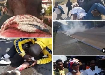 Bloody Tuesday As Several Protesters Sustained Wounds